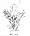 Fig. 10 - Gripper pusher mechanism for tissue apposition systems