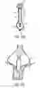 Fig. 12 - Gripper pusher mechanism for tissue apposition systems