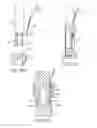 Fig. 24 - Gripper pusher mechanism for tissue apposition systems