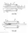 Fig. 48 - Gripper pusher mechanism for tissue apposition systems