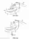 Fig. 56 - Gripper pusher mechanism for tissue apposition systems