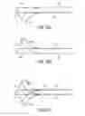 Fig. 57 - Gripper pusher mechanism for tissue apposition systems