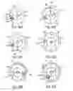 Fig. 69 - Gripper pusher mechanism for tissue apposition systems