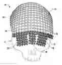 Fig. 01 - Universal Cranioplasty Mesh