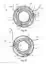 Fig. 08 - Tissue fixation device to grasp, retain and release tissue