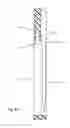 Fig. 35 - Tissue fixation device to grasp, retain and release tissue