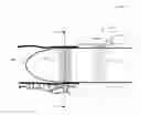 Fig. 01 - Anastomosis probe and cutting device