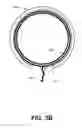 Fig. 05 - Anastomosis probe and cutting device