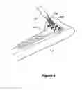 Fig. 07 - BONE FIXATION DEVICE