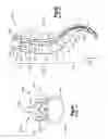 Fig. 02 - TIGHTENING DEVICE FOR SPINE SURGERY
