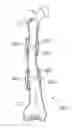 Fig. 01 - METHODS AND APPARATUS FOR BONE RESHAPING