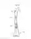 Fig. 06 - METHODS AND APPARATUS FOR BONE RESHAPING