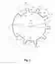 Fig. 03 - Variable depression stents (VDS) and billowing graft assemblies