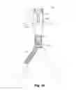 Fig. 25 - Variable depression stents (VDS) and billowing graft assemblies