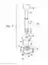 Fig. 07 - Adjustable annuloplasty devices and adjustment mechanisms therefor
