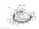 Fig. 14 - Adjustable annuloplasty devices and adjustment mechanisms therefor