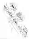 Fig. 17 - Adjustable annuloplasty devices and adjustment mechanisms therefor