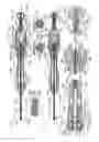 Fig. 20 - Adjustable annuloplasty devices and adjustment mechanisms therefor