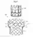 Fig. 09 - Rapid deployment prosthetic heart valve
