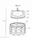 Fig. 11 - Rapid deployment prosthetic heart valve