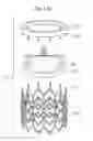 Fig. 15 - Rapid deployment prosthetic heart valve