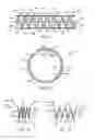 Fig. 04 - Passive artificial sphincter