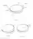 Fig. 35 - Methods and devices for less invasive glenoid replacement