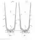 Fig. 04 - Socket system including a vacuum liner for prosthetic or orthotic devices and associated methods
