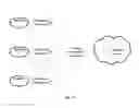 Fig. 11 - Bandwidth management device, central management device and method of bandwidth management