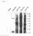 Fig. 04 - PLANTS HAVING ENHANCED YIELD-RELATED TRAITS AND A METHOD FOR MAKING THE SAME