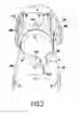 Fig. 03 - DEVICE FOR PROTECTING THE KNEE JOINT WITH A STRAP