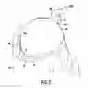 Fig. 04 - DEVICE FOR PROTECTING THE KNEE JOINT WITH A STRAP