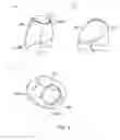 Fig. 03 - Bottom Garment