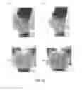 Fig. 15 - Bottom Garment