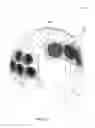 Fig. 15 - Sports equipment that employ force-absorbing elements