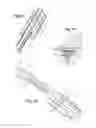 Fig. 06 - Locking device between a wiper blade and a windscreen wiper blade holder