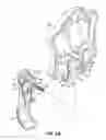 Fig. 04 - Casket hardware attachment structure