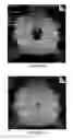 Fig. 15 - Implantable medical device