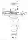 Fig. 04 - Gas turbine engine combustor with CMC heat shield and methods therefor