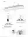 Fig. 04 - WATERPROOF SCREW, SEALING MATERIAL, METHOD FOR STRUCTURE INSTALLATION, AND STRUCTURE FOR STRUCTURE INSTALLATION