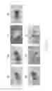 Fig. 03 - Acoustic particulate concentration methods and system