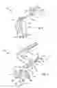 Fig. 07 - Fences for table saws