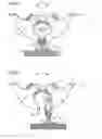 Fig. 02 - Method and device for protection against guiding loss for a guided vehicle