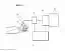 Fig. 01 - System and method for diagnosis and treatment of a breathing pattern of a patient