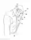 Fig. 01 - POST VITRECTOMY POSITION STABILIZER