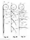 Fig. 17 - Retractable shade with collapsible vanes