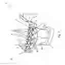 Fig. 03 - BAFFLE PLATE IN A HEAT EXCHANGER