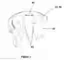 Fig. 02 - SLIP ASSEMBLY