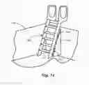 Fig. 17 - Pool ladder safety system