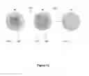 Fig. 16 - Droplet Actuator Devices and Methods for Manipulating Beads